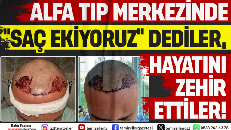 alfa-tip-merkezinde-sac-ekiyoruz-dediler-hayati-zehir-ettiler-KSsv2r2t.png